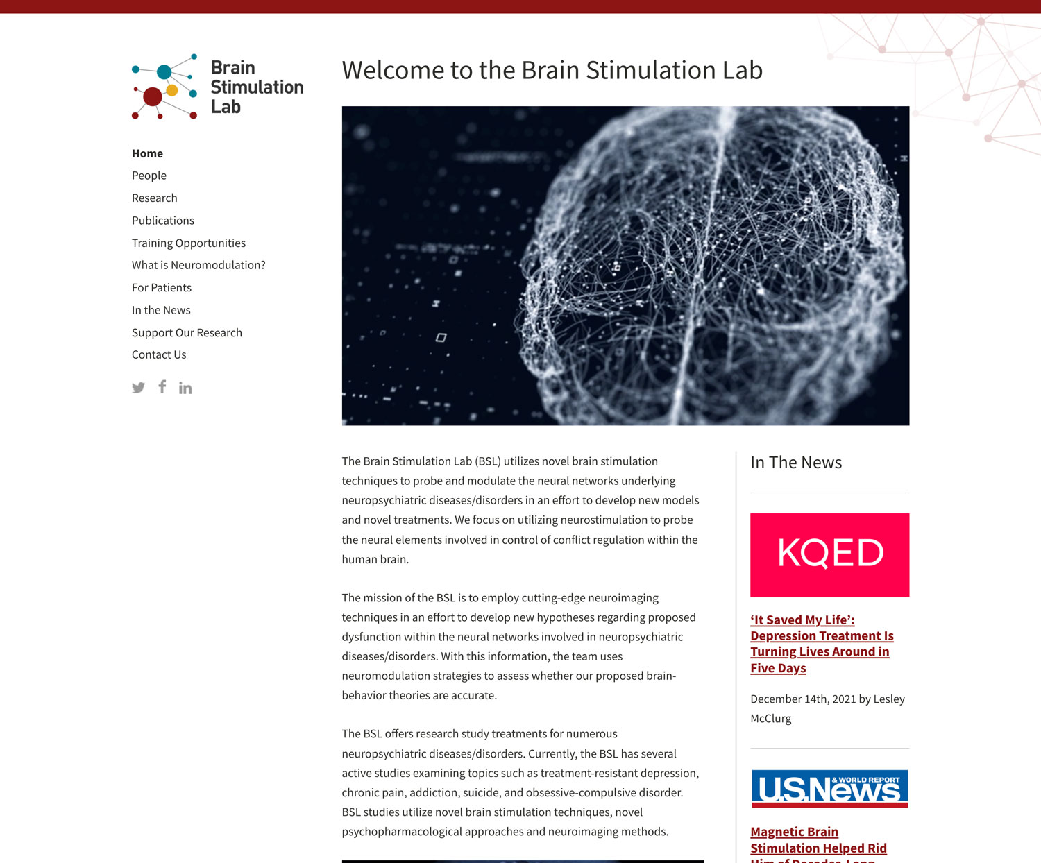 Brain Stimulation Lab at Stanford University